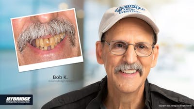 Smile Makeovers Before & After Gallery - Patient 93780850 - Image 1