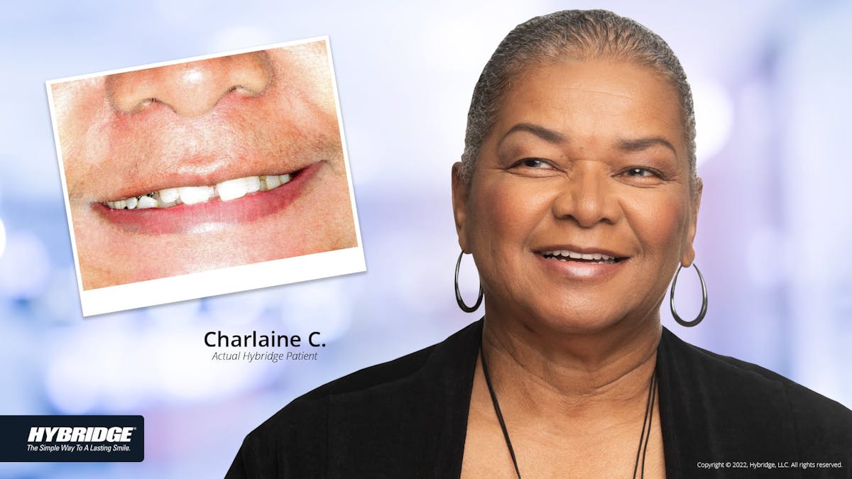 Smile Makeovers Before & After Gallery - Patient 93780849 - Image 1