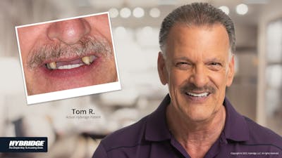 Smile Makeovers Before & After Gallery - Patient 93780846 - Image 1