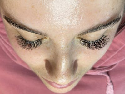 Eyelash Extension Before & After Gallery - Patient 87551950 - Image 2