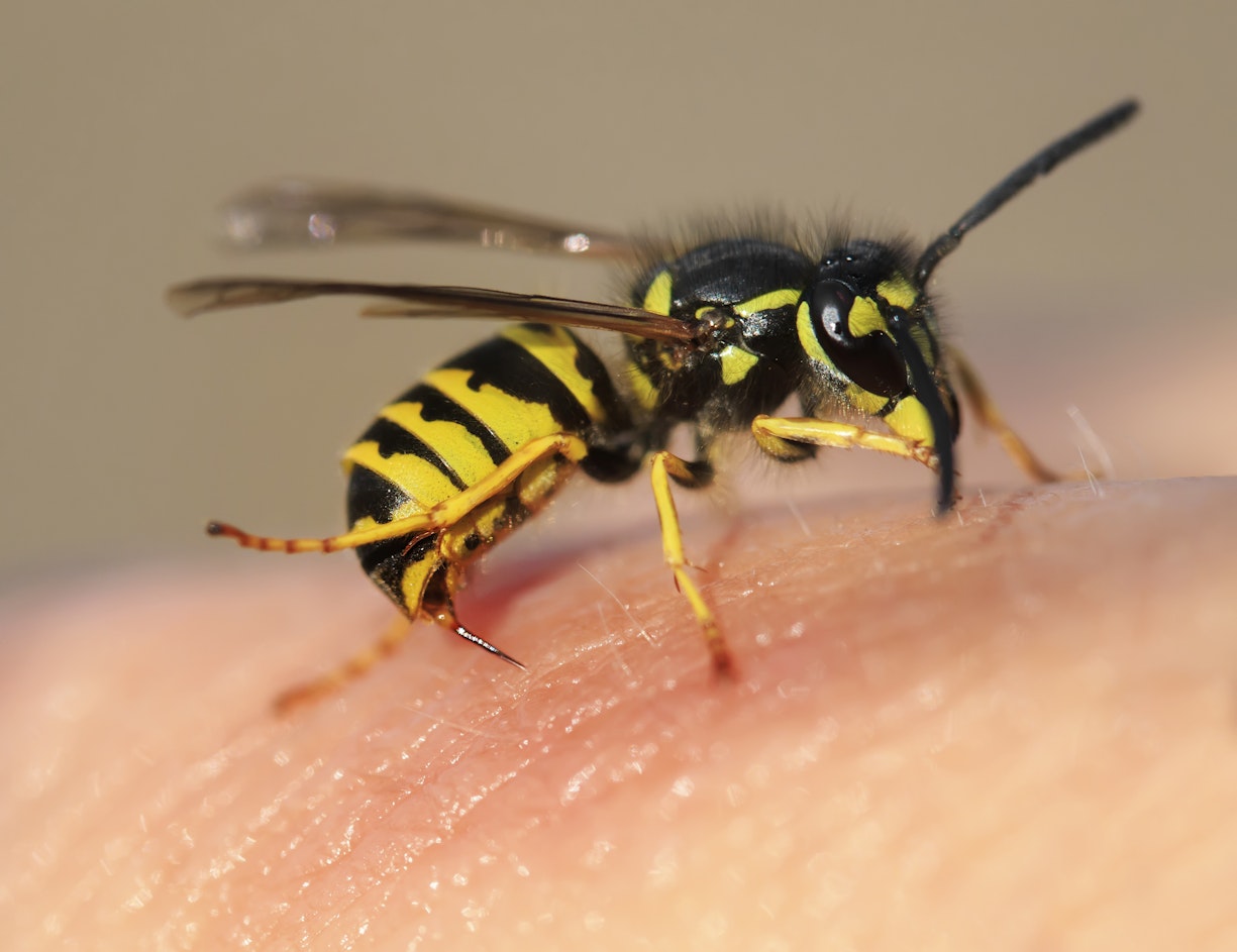 Wasp stinging a person's arm