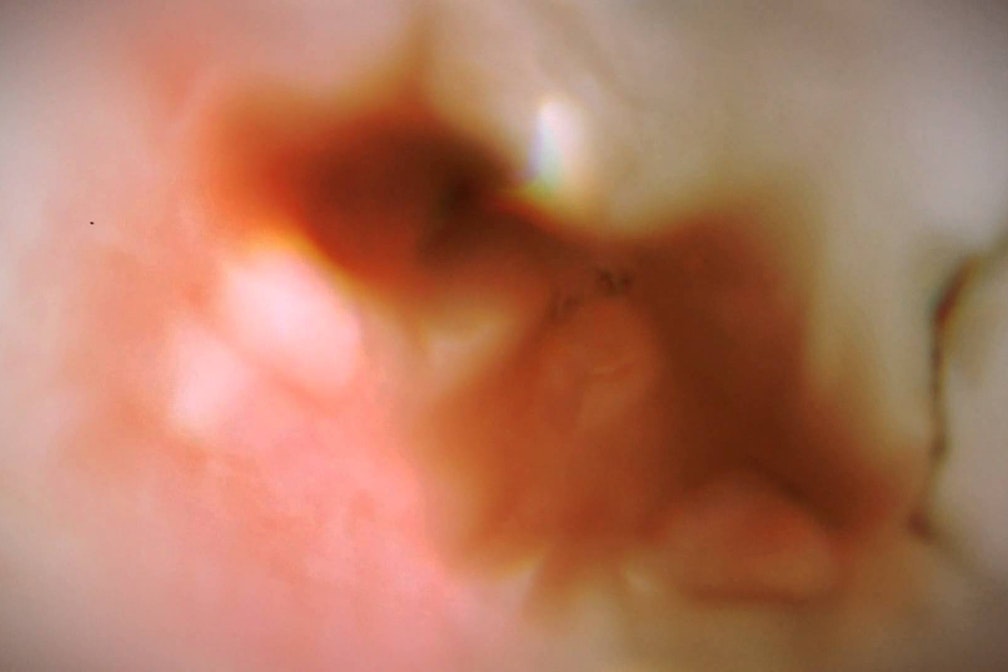 Satelliti: Bringing It All Back Home