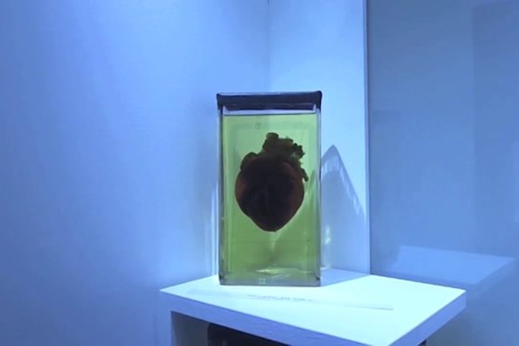 39NULL, die 2. – größere Herausforderung – doch sie bleiben dran