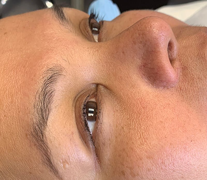 Permanent Makeup Before & After Gallery - Patient 93898071 - Image 1