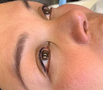Permanent Makeup Before & After Gallery - Patient 93898071 - Image 2