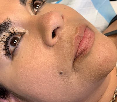 Permanent Makeup Before & After Gallery - Patient 93898075 - Image 1