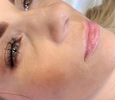 Permanent Makeup Before & After Gallery - Patient 93898094 - Image 1