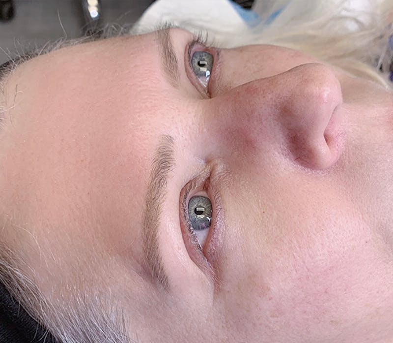 Permanent Makeup Before & After Gallery - Patient 93898124 - Image 1