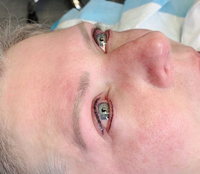 Permanent Makeup Before & After Gallery - Patient 93898124 - Image 2