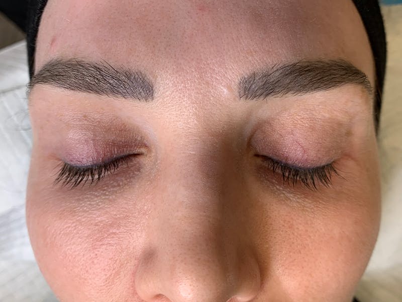 Permanent Makeup Before & After Gallery - Patient 93898152 - Image 1
