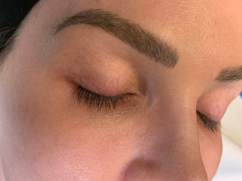 Permanent Makeup Before & After Gallery - Patient 93898152 - Image 3