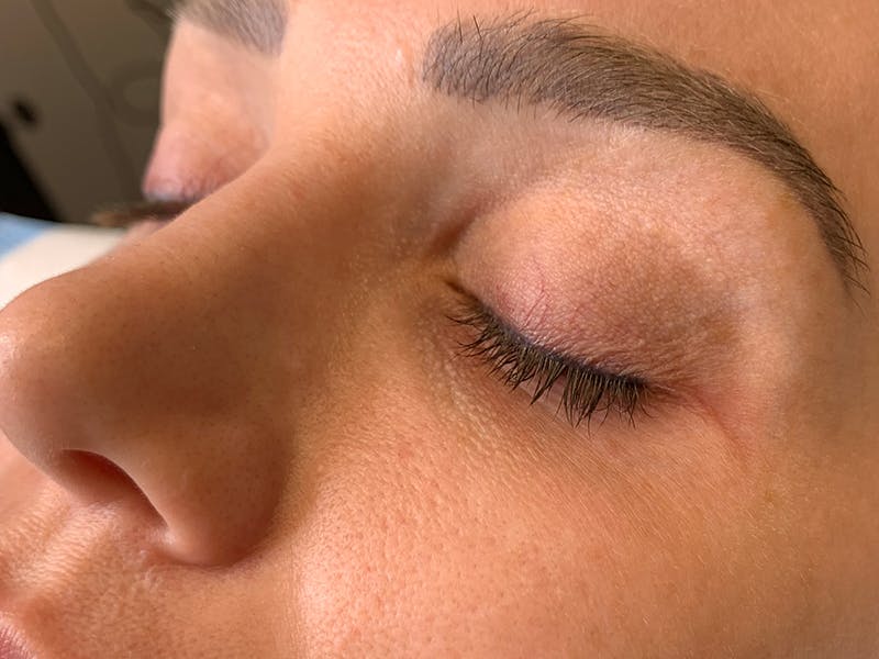 Permanent Makeup Before & After Gallery - Patient 93898152 - Image 5