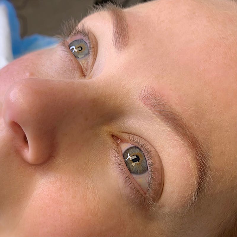 3D Microblading/ Henna Brows Before & After Gallery - Patient 93899232 - Image 2
