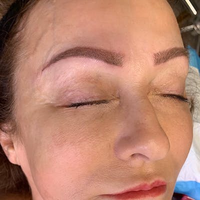 3D Microblading/ Henna Brows Before & After Gallery - Patient 93899261 - Image 2