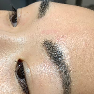 3D Microblading/ Henna Brows Before & After Gallery - Patient 93899268 - Image 1
