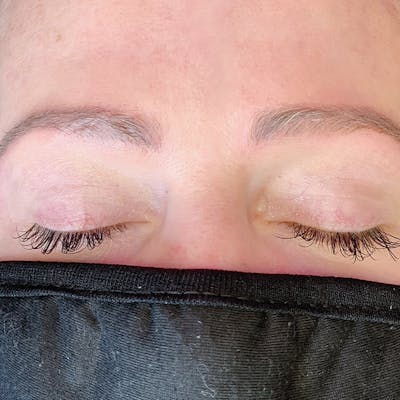 3D Microblading/ Henna Brows Before & After Gallery - Patient 93899297 - Image 2