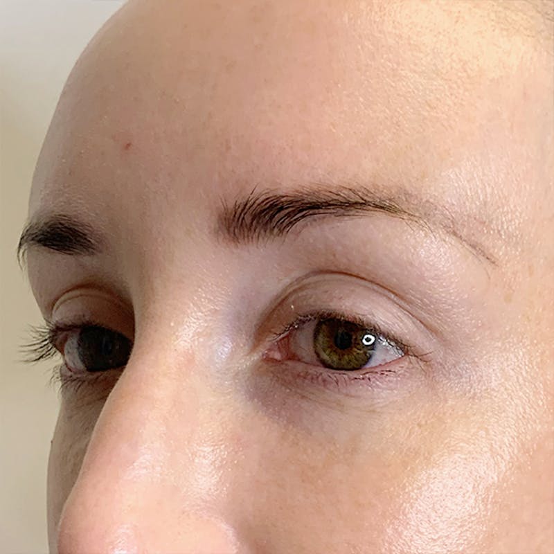 3D Microblading/ Henna Brows Before & After Gallery - Patient 93899331 - Image 1