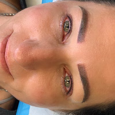 3D Microblading/ Henna Brows Before & After Gallery - Patient 93899346 - Image 2