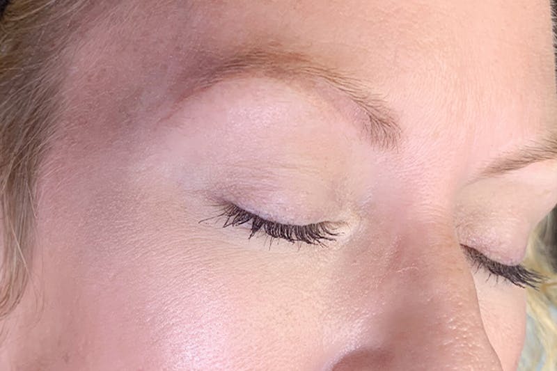 3D Microblading/ Henna Brows Before & After Gallery - Patient 93899348 - Image 1