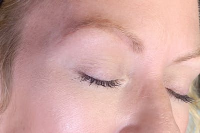 3D Microblading/ Henna Brows Before & After Gallery - Patient 93899348 - Image 1