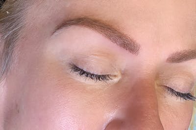 3D Microblading/ Henna Brows Before & After Gallery - Patient 93899348 - Image 2
