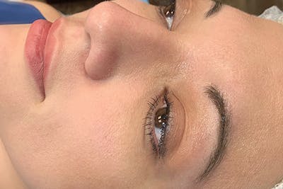 3D Microblading/ Henna Brows Before & After Gallery - Patient 93899351 - Image 1