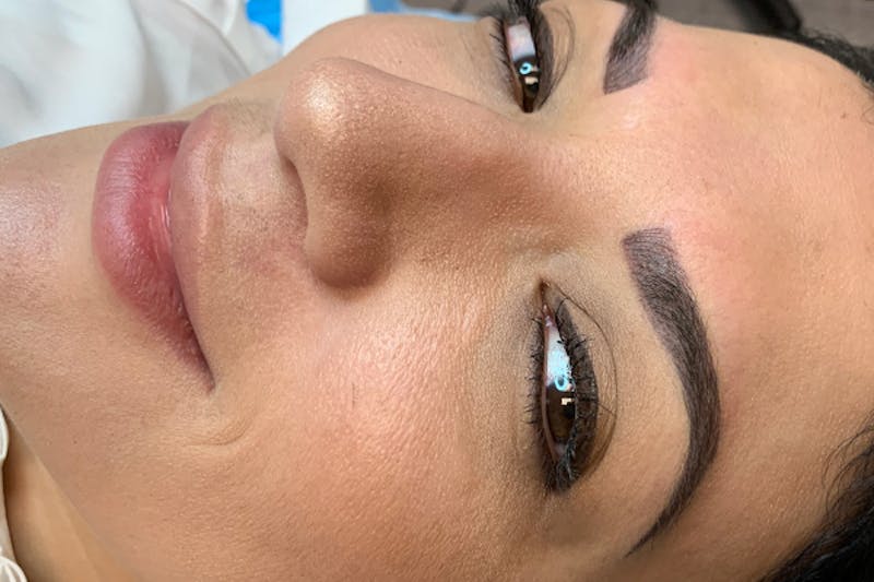 3D Microblading/ Henna Brows Before & After Gallery - Patient 93899351 - Image 2