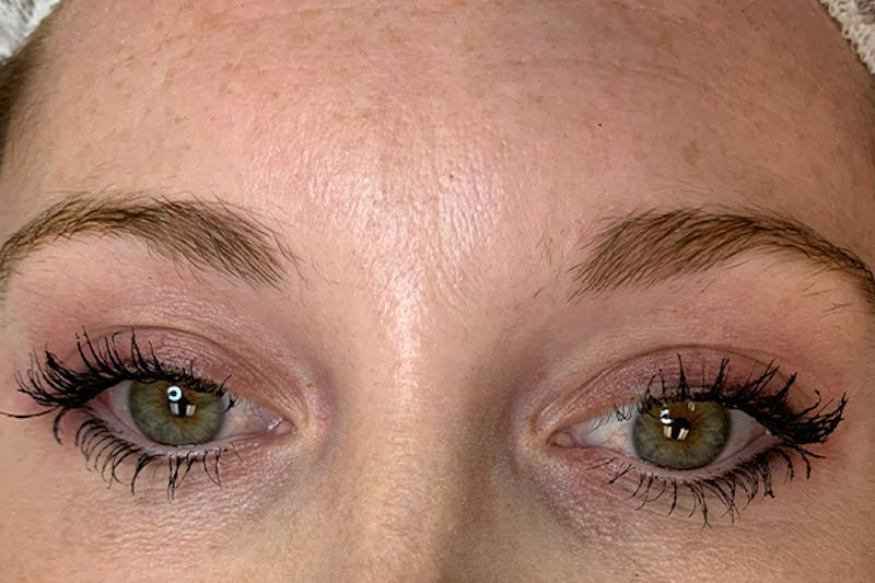 3D Microblading/ Henna Brows Before & After Gallery - Patient 93899380 - Image 1