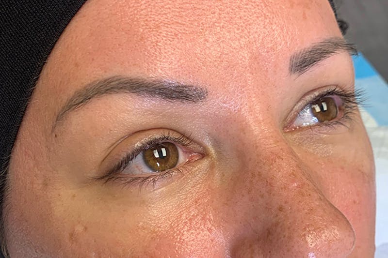 3D Microblading/ Henna Brows Before & After Gallery - Patient 93899387 - Image 1