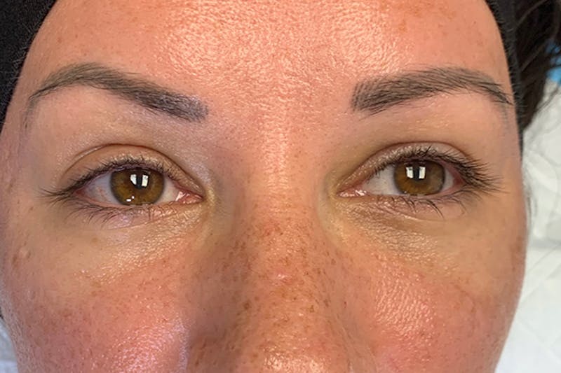 3D Microblading/ Henna Brows Before & After Gallery - Patient 93899387 - Image 3