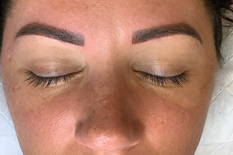 3D Microblading/ Henna Brows Before & After Gallery - Patient 93899387 - Image 4