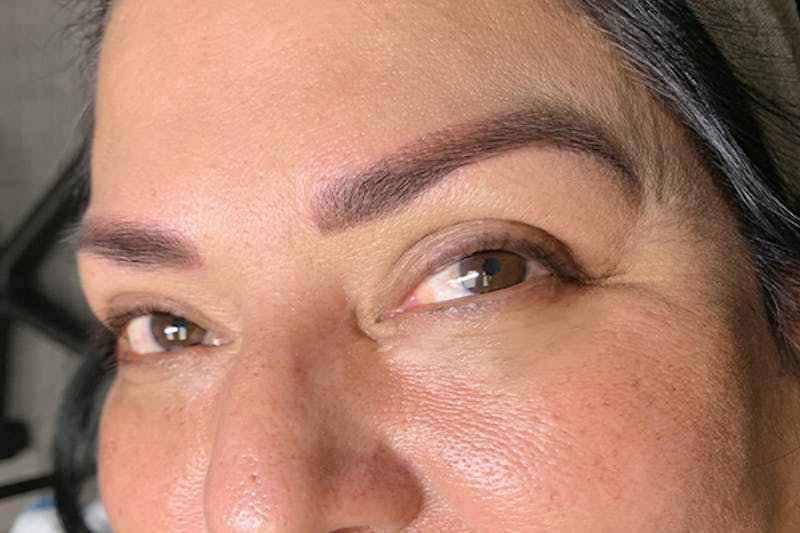 3D Microblading/ Henna Brows Before & After Gallery - Patient 93899404 - Image 2