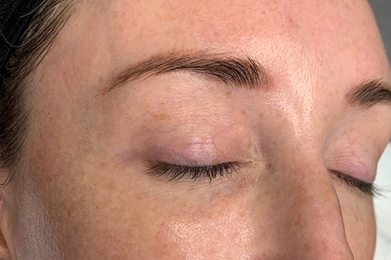 3D Microblading/ Henna Brows Before & After Gallery - Patient 93899426 - Image 1