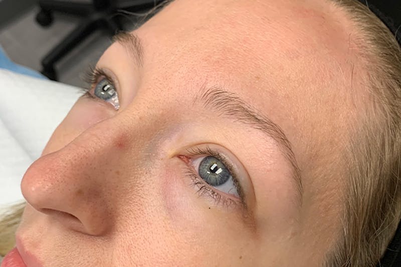 3D Microblading/ Henna Brows Before & After Gallery - Patient 93899433 - Image 1