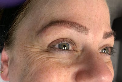 3D Microblading/ Henna Brows Before & After Gallery - Patient 93899460 - Image 2
