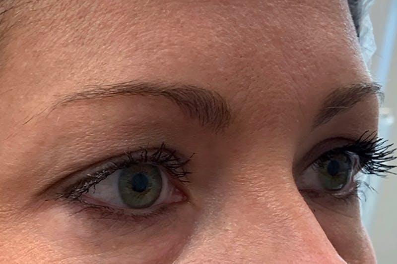 3D Microblading/ Henna Brows Before & After Gallery - Patient 93899464 - Image 1