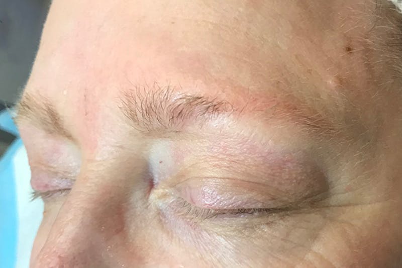 3D Microblading/ Henna Brows Before & After Gallery - Patient 93899468 - Image 1