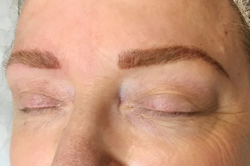 3D Microblading/ Henna Brows Before & After Gallery - Patient 93899468 - Image 2