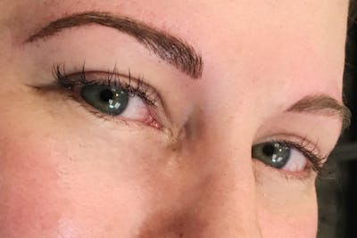 3D Microblading/ Henna Brows Before & After Gallery - Patient 93899478 - Image 2
