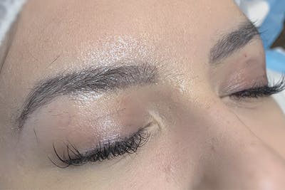 3D Microblading/ Henna Brows Before & After Gallery - Patient 93899494 - Image 1