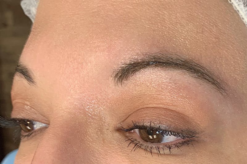 3D Microblading/ Henna Brows Before & After Gallery - Patient 93899512 - Image 1