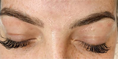 3D Microblading/ Henna Brows Before & After Gallery - Patient 93899542 - Image 1