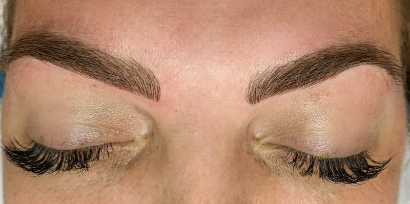 3D Microblading/ Henna Brows Before & After Gallery - Patient 93899542 - Image 2