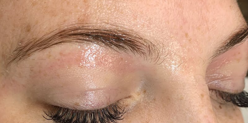 3D Microblading/ Henna Brows Before & After Gallery - Patient 93899542 - Image 3