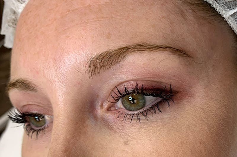 3D Microblading/ Henna Brows Before & After Gallery - Patient 93899557 - Image 1