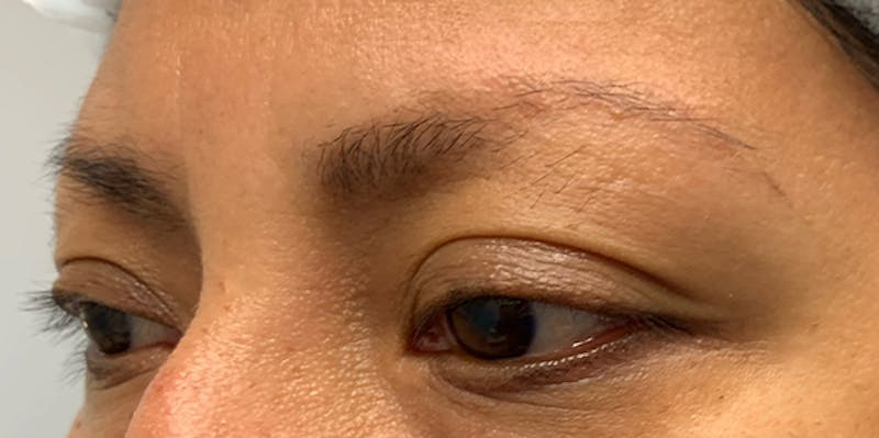 3D Microblading/ Henna Brows Before & After Gallery - Patient 93899572 - Image 1