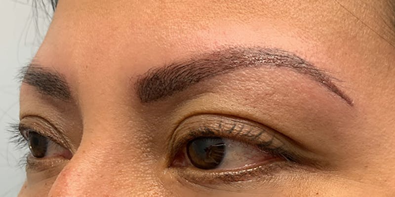 3D Microblading/ Henna Brows Before & After Gallery - Patient 93899572 - Image 2