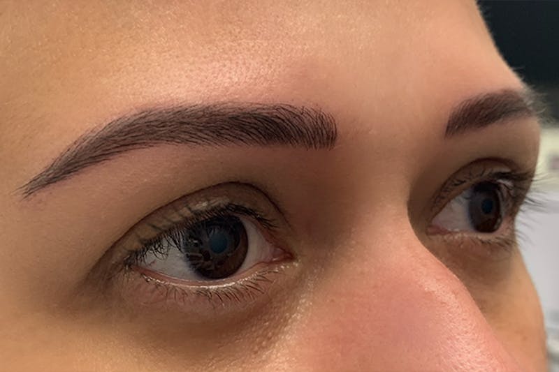 3D Microblading/ Henna Brows Before & After Gallery - Patient 93899591 - Image 2