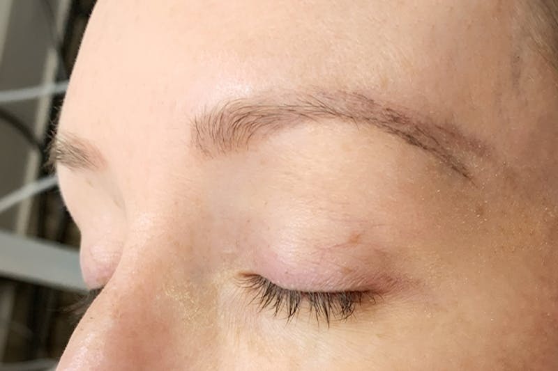 3D Microblading/ Henna Brows Before & After Gallery - Patient 93899624 - Image 1