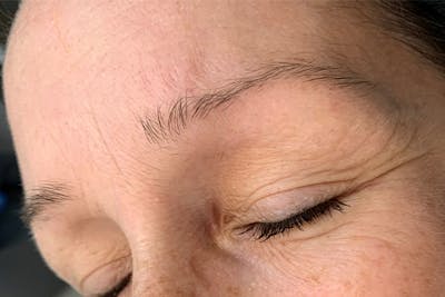 3D Microblading/ Henna Brows Before & After Gallery - Patient 93899673 - Image 1